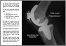 knee arthroplasty